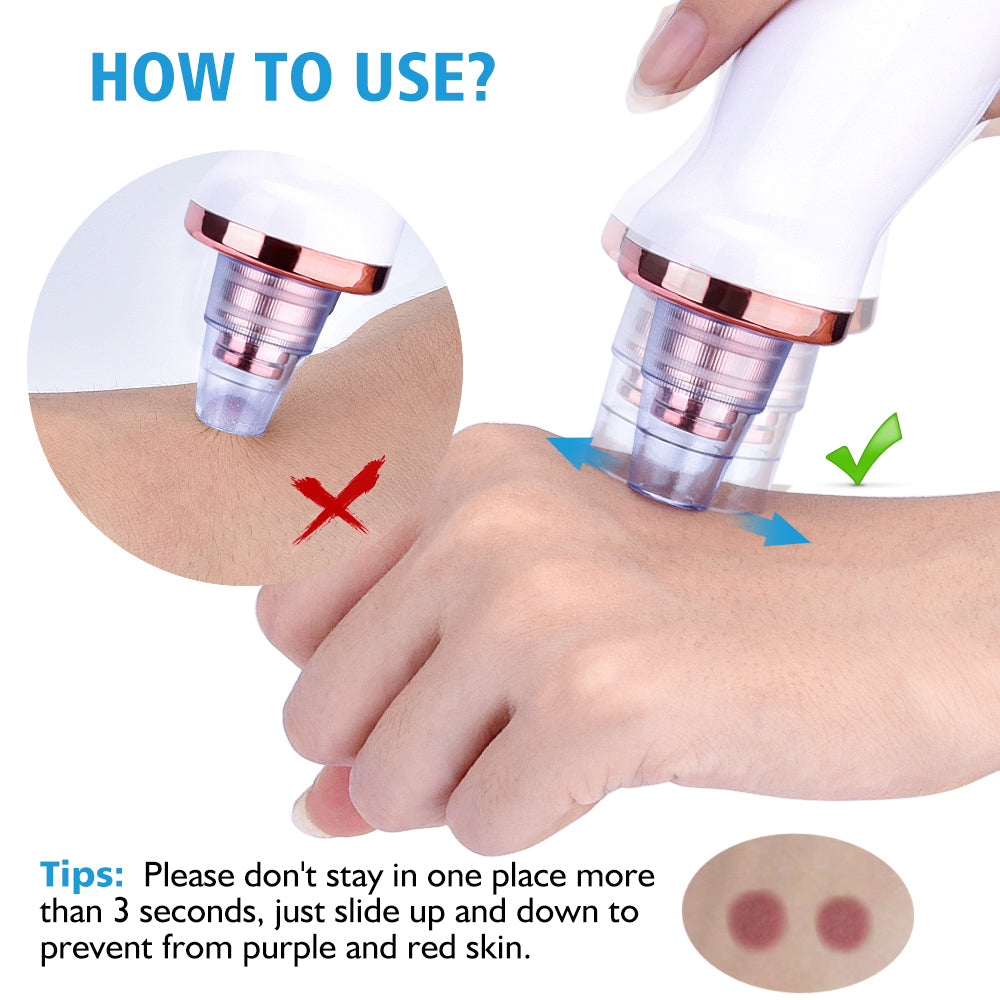 Blackhead Instrument Electric Suction Facial Washing Instrument Beauty Acne Cleaning Blackhead Suction Instrument - QWIEL®