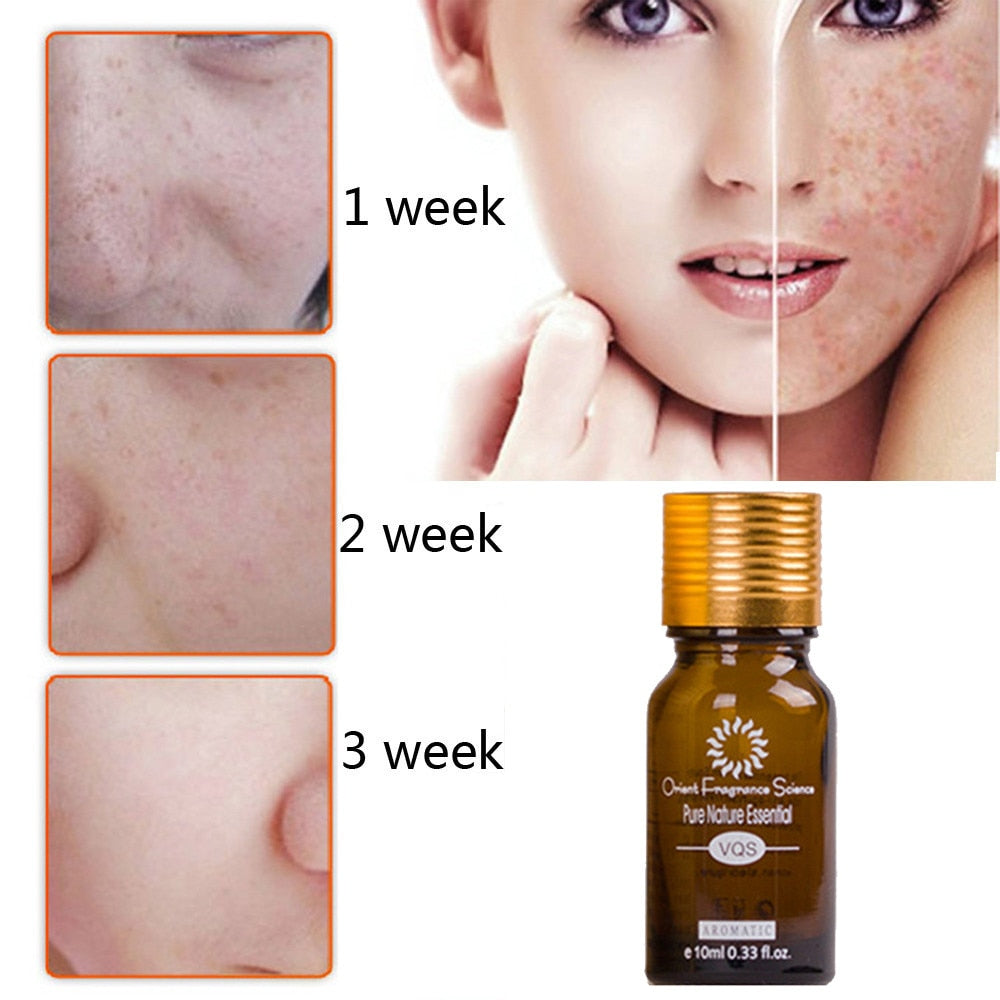 Dredge Meridian Skin Care Natural Pure Removal Acne Stretch Marks Scar Removal Essence oil - QWIEL®