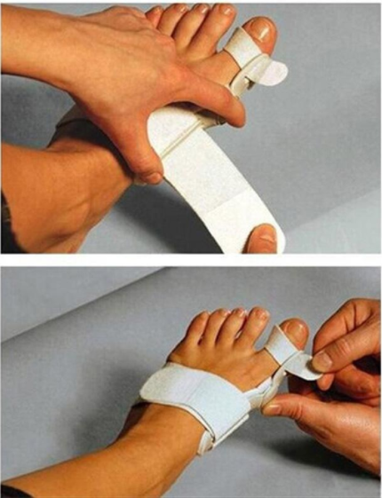 Hallux Valgus Corrector With Foot Valgus Separator - QWIEL®