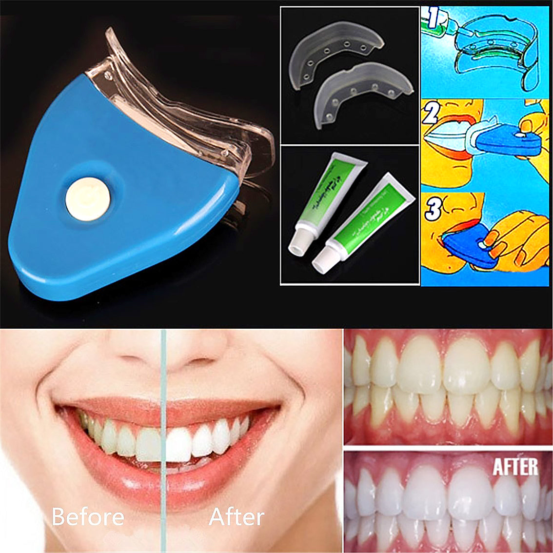 Oral Gel Teeth Tooth Whitening Whitener Dental Bleaching LED - QWIEL®